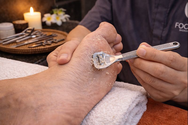 Removal Of Foot Cracks